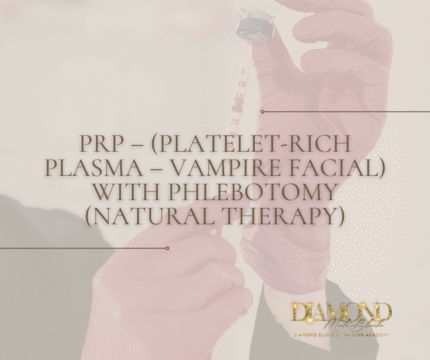 PRP – (PLATELET-RICH PLASMA - VAMPIRE FACIAL) with PHLEBOTOMY (Natural Therapy)